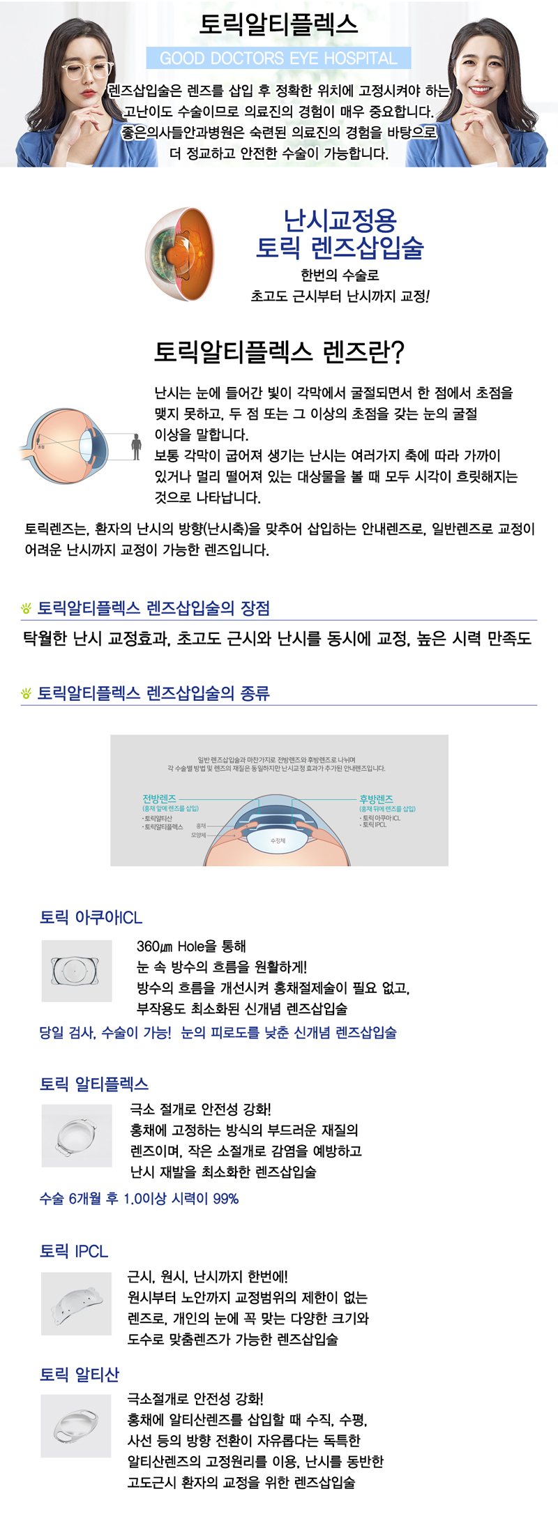 토릭알티플렉스